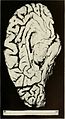 Bulletin of the Massachusetts Department of Mental Diseases (1920) (14586771679).jpg