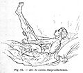 J. M. Charcot, Lecons du mardi, Paris; 1887 Wellcome L0020064.jpg
