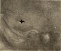 Nervous and mental diseases (1911) (14591792048).jpg