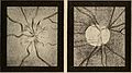 Nervous and mental diseases (1911) (14755090706).jpg