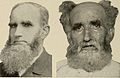 Nervous and mental diseases (1919) (14594861008).jpg