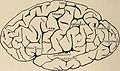 Nervous and mental diseases (1911) (14591435540).jpg