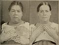 Nervous and mental diseases (1919) (14595218397).jpg