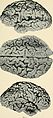 Bulletin of the Massachusetts Department of Mental Diseases (1920) (14770235391).jpg