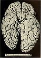 Bulletin of the Massachusetts Department of Mental Diseases (1920) (14586781268).jpg