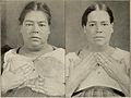 Nervous and mental diseases (1911) (14778101982).jpg