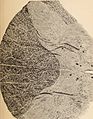 Archives of neurology and psychopathology. (1900) (14592321439).jpg