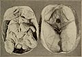Nervous and mental diseases (1919) (14779457554).jpg