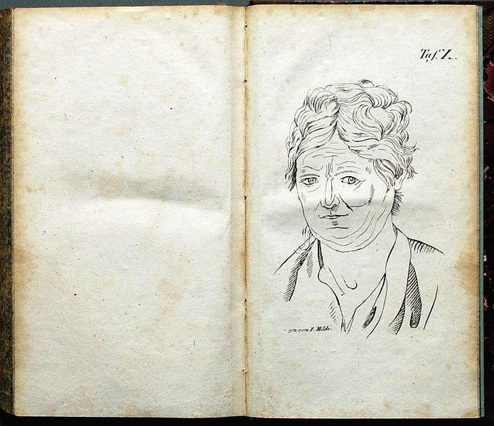 File:Esquirol 1827 -Tafel X-.jpg