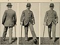 Nervous and mental diseases (1911) (14591516529).jpg