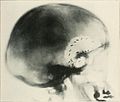 A. M. A. archives of neurology and psychiatry (1919) (14593359860).jpg