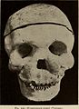 Nervous and mental diseases (1919) (14778583251).jpg