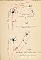 Archives of neurology and psychopathology. (1900) (14592279408).jpg