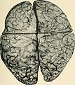 Bulletin of the Massachusetts Department of Mental Diseases (1920) (14793283363).jpg