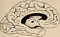 Nervous and mental diseases (1911) (14775794734).jpg
