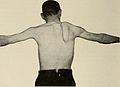 Nervous and mental diseases (1919) (14781253822).jpg