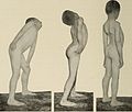 Nervous and mental diseases (1919) (14781687035).jpg
