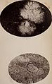American journal of insanity (1874) (14592285718).jpg
