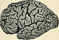Bulletin of the Massachusetts Department of Mental Diseases (1920) (14793276663).jpg