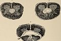 Nervous and mental diseases (1911) (14591651489).jpg