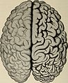 Nervous and mental diseases (1919) (14781822285).jpg