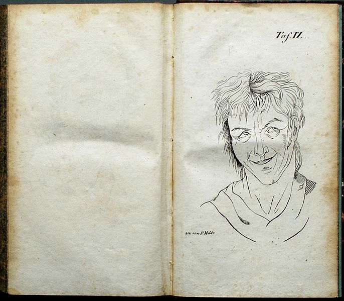 File:Esquirol 1827 -Tafel IX-.jpg