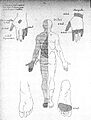 J. M. Charcot, Lecons du mardi, Paris; 1887 Wellcome L0020062.jpg