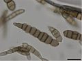 Alternaria brassicicola conidia3.jpg