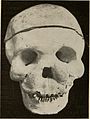 Nervous and mental diseases (1911) (14591734090).jpg