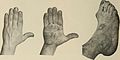 Nervous and mental diseases (1919) (14595053159).jpg