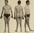 Nervous and mental diseases (1919) (14778536831).jpg