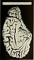 Bulletin of the Massachusetts Department of Mental Diseases (1920) (14793292513).jpg