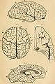 A Dictionary of psychological medicine giving the definition, etymology and synonyms of the terms used in medical psychology, with the symptoms, treatment, and pathology of insanity and the law of (14781082665).jpg
