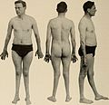 Nervous and mental diseases (1911) (14591720128).jpg