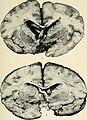 Bulletin of the Massachusetts Department of Mental Diseases (1920) (14586765059).jpg