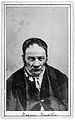 Albumen prints; photographs of patients at Wellcome L0019067.jpg