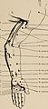 Nervous and mental diseases (1911) (14777701732).jpg