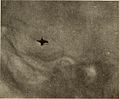 Nervous and mental diseases (1919) (14595008600).jpg