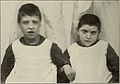 Nervous and mental diseases (1919) (14595097410).jpg