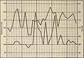 Nervous and mental diseases (1911) (14591580147).jpg