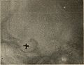 Nervous and mental diseases (1911) (14591935627).jpg