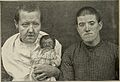Nervous and mental diseases (1919) (14595148369).jpg