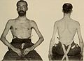 Nervous and mental diseases (1919) (14595033768).jpg